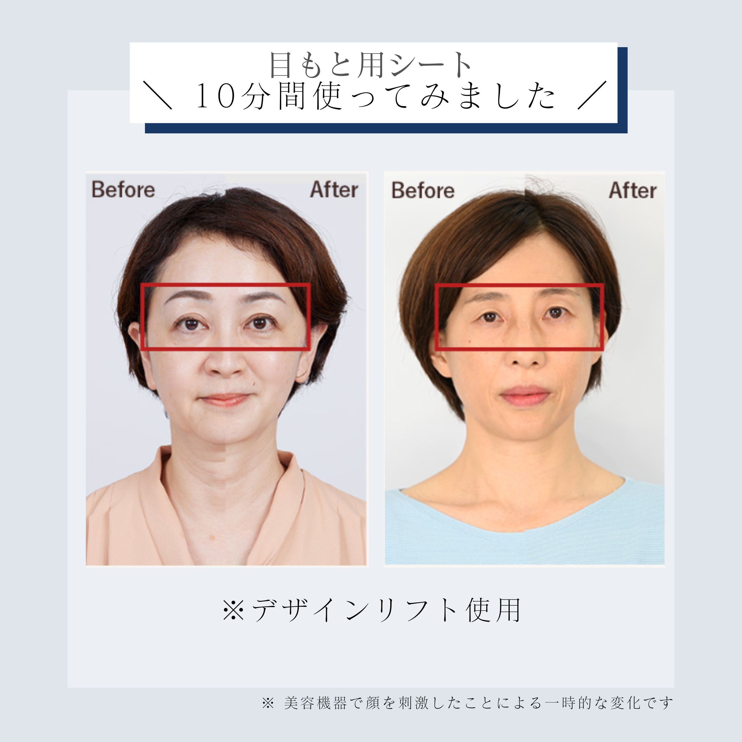 デザインリフトモア目もと＆口もとWケア4か月コース（初回豪華特典付き