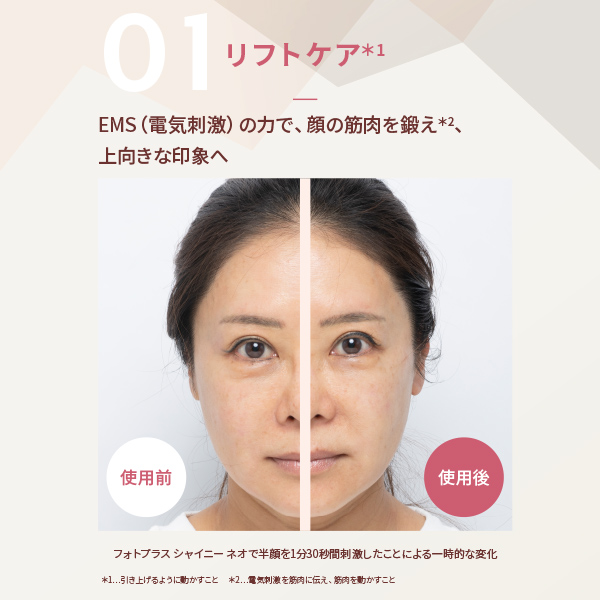 LP限定】RF美顔器 フォトプラス シャイニー ネオ 特別セット｜ヤーマン