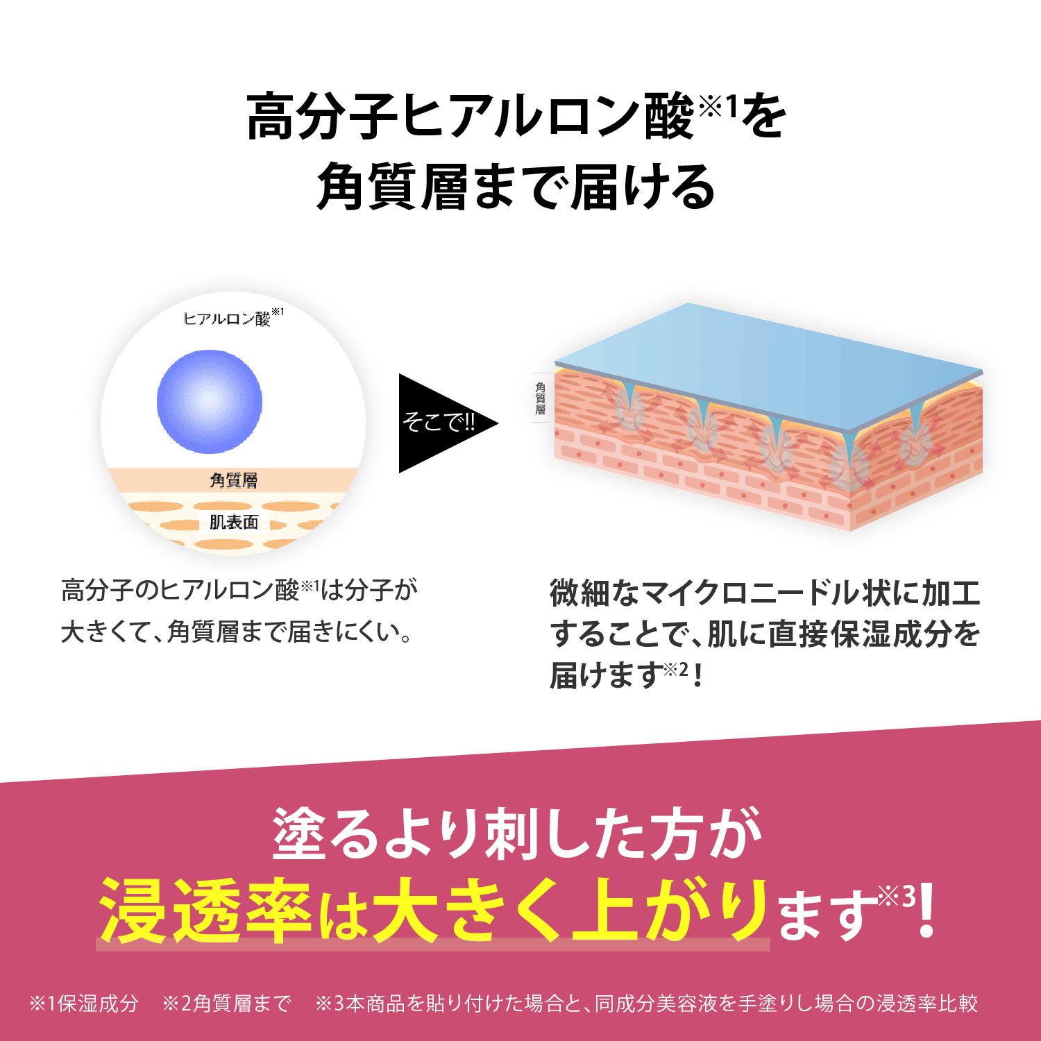 メディリフト マイクロフィラー フォアヘッド｜Medi Lift