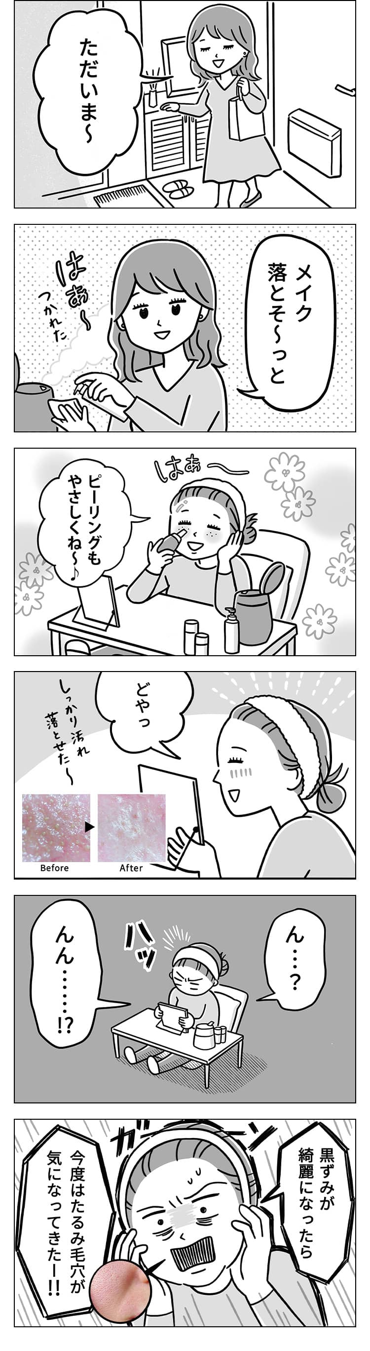 毛穴問題の漫画