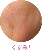 くすみ