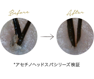 毛穴の頭皮洗浄
