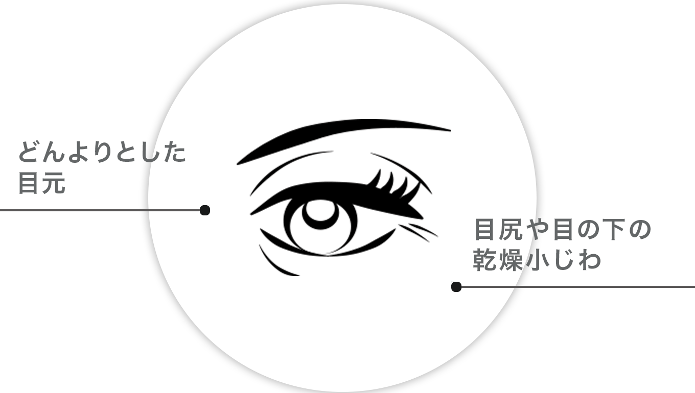 口もとの年齢サインが年々くっきりしてきた / 高級な基礎化粧品を使ってもなかなか実感ができない / 口もとの印象をアップして笑顔に自信を持ちたい