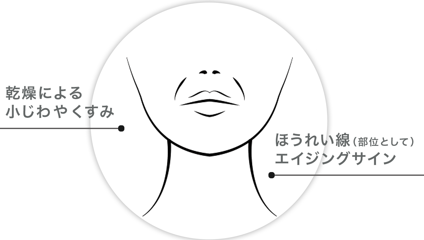 口もとの年齢サインが年々くっきりしてきた / 高級な基礎化粧品を使ってもなかなか実感ができない / 口もとの印象をアップして笑顔に自信を持ちたい