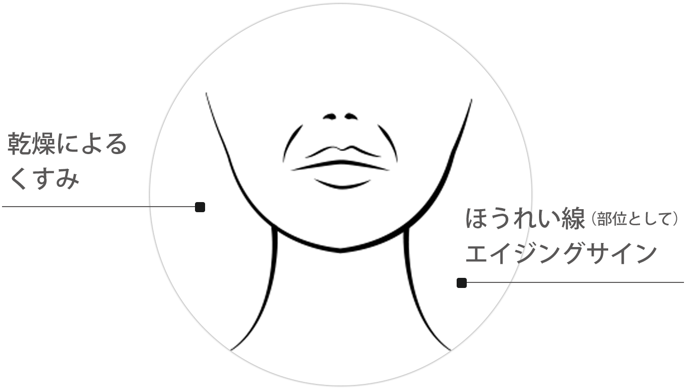 口もとの年齢サインが年々くっきりしてきた / 高級な基礎化粧品を使ってもなかなか実感ができない / 口もとの印象をアップして笑顔に自信を持ちたい