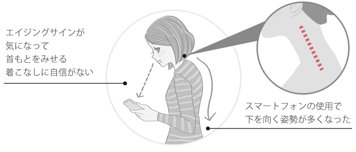 頬や口もとのゆるみ/口角が下がって不機嫌に見られがち/エイジングサインが気になって首もとをみせる着こなしに自信がない/ねこ背に見られがち