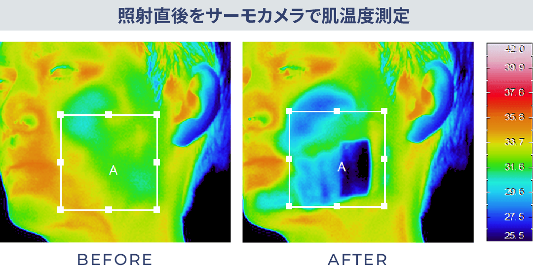 照射直後をサーモカメラで肌温度測定