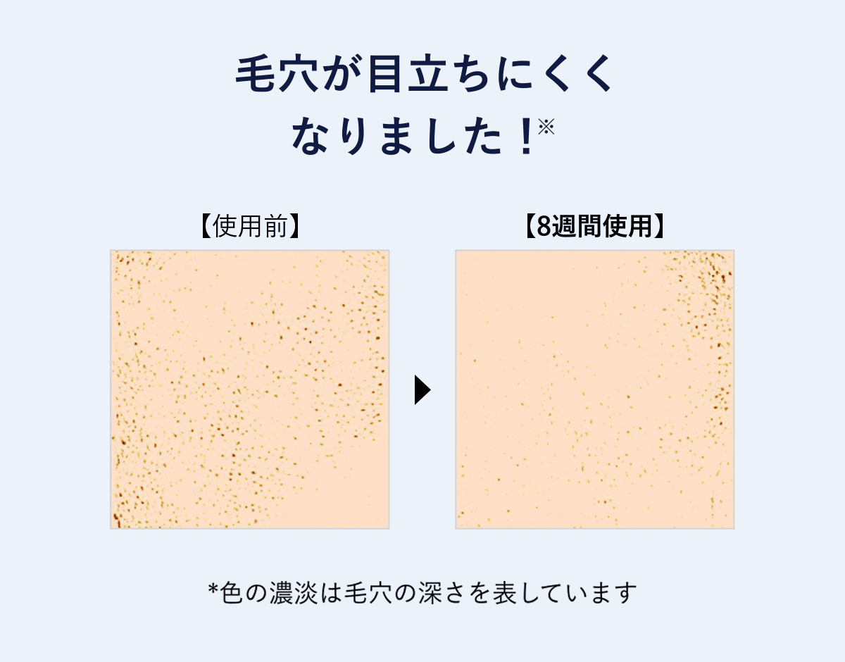 毛穴が目立ちにくくなりました!