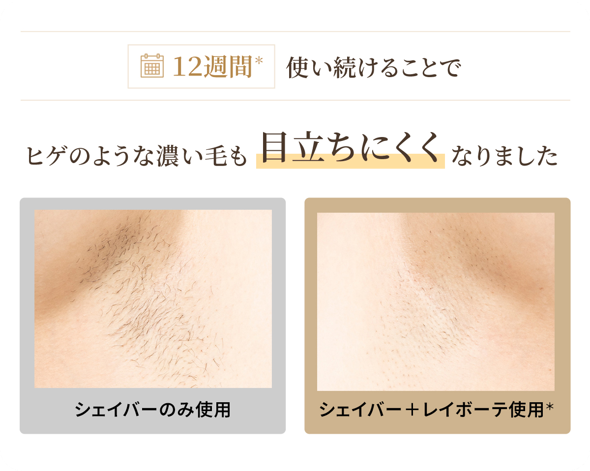 ヒゲのような濃い毛も目立ちにくくなりました