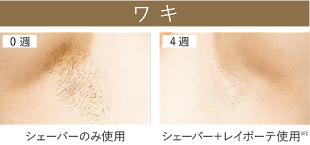 ワキ 0週 シェーバーのみ使用 4週 シェーバー＋レイボーテ使用