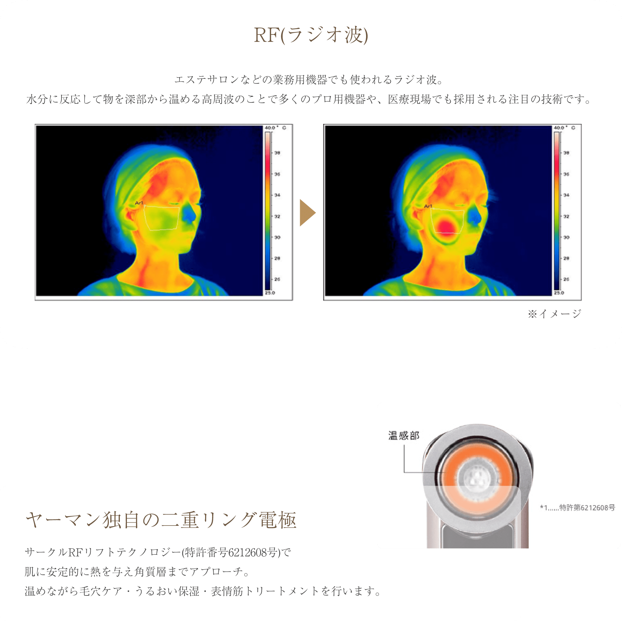 エステのケアをご自宅で RF(ラジオ波) エステサロンなどの業務用機器でも使われるラジオ波。水分に反応して物を深部から温める高周波のことで多くのプロ用機器や、医療現場でも採用される注目の技術です。 ※イメージ ヤーマン独自の二重リング電極 サークルRFリフトテクノロジー(特許番号6212608号)で肌に安定的に熱を与え角質層までアプローチ。 温めながら毛穴ケア・潤い保湿・表情筋トリートメントを行います。 温感部 ※1…特許番号6212608号