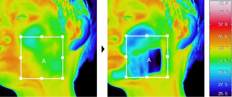照射直後をサーモカメラで肌温度測定