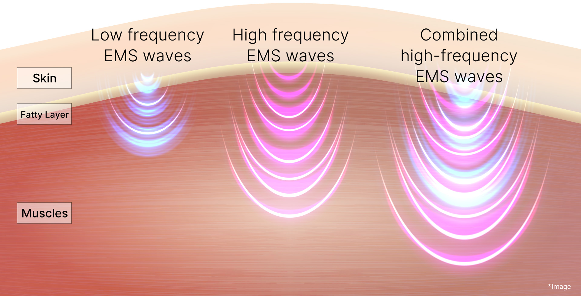 EMS