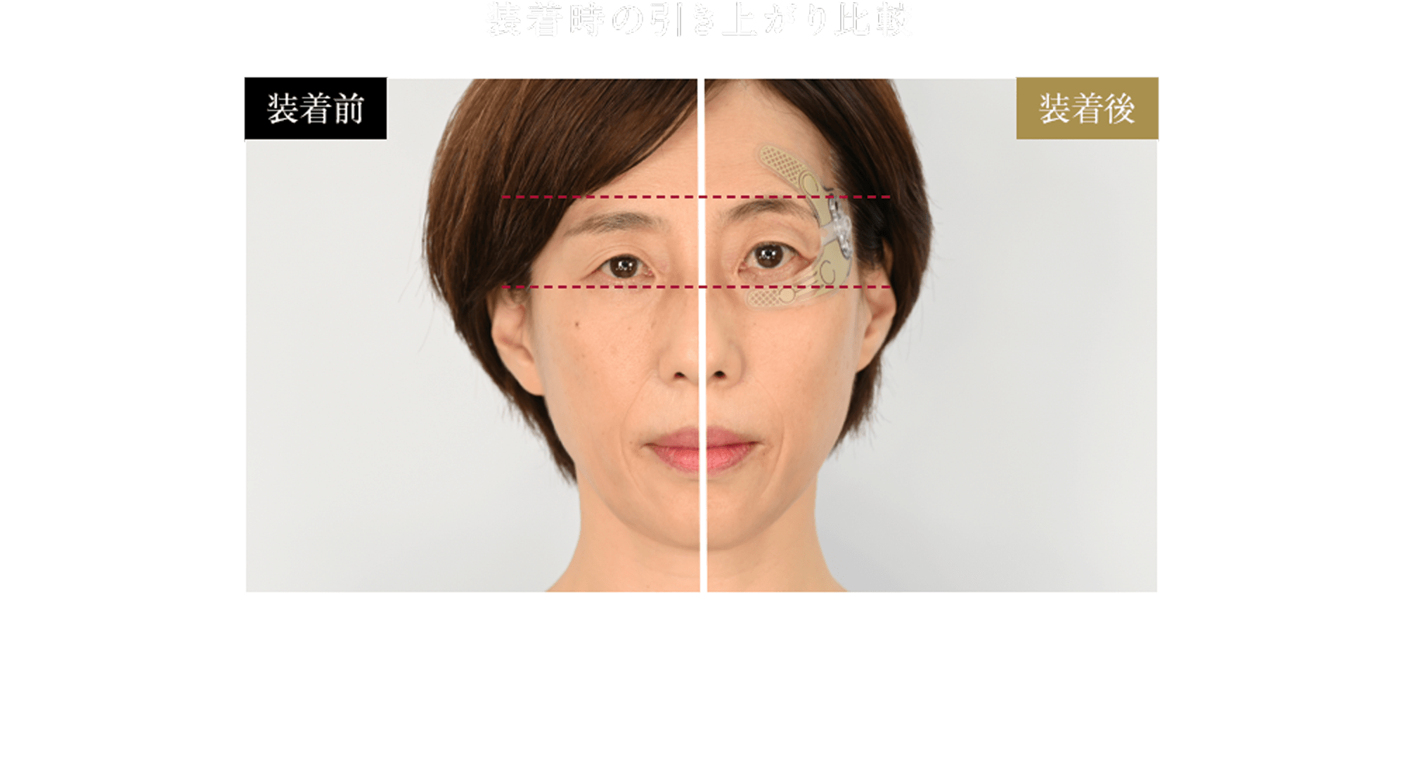 正しい位置にEMSを放出し 理想の目もとへ