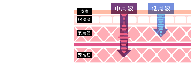 デザインリフトは 低周波と中周波の組み合わせで筋肉の表層と深層両方にアプローチ。