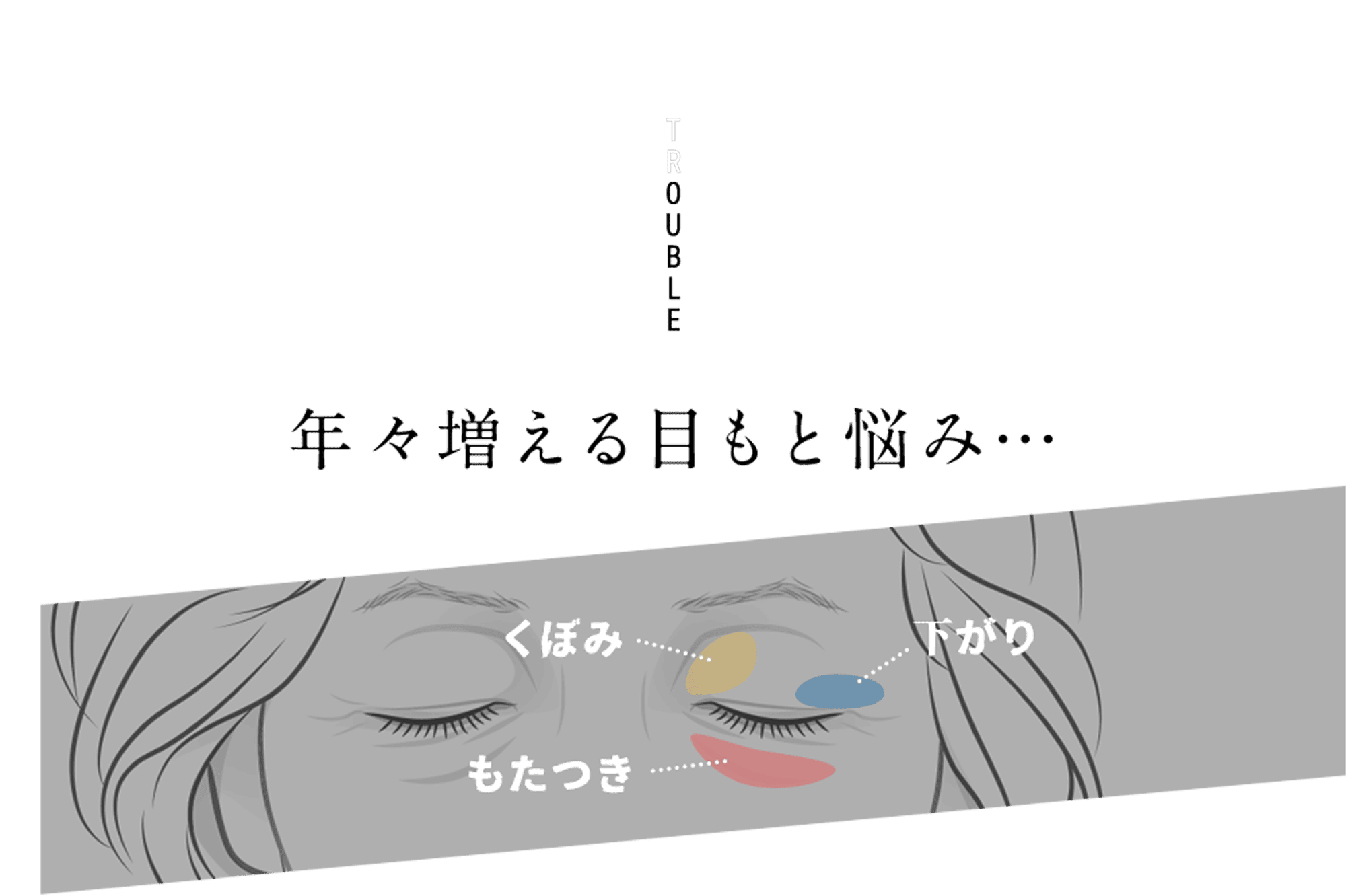 TROUBLE 年々増える目もと悩み… くぼみ もたつき 下がり