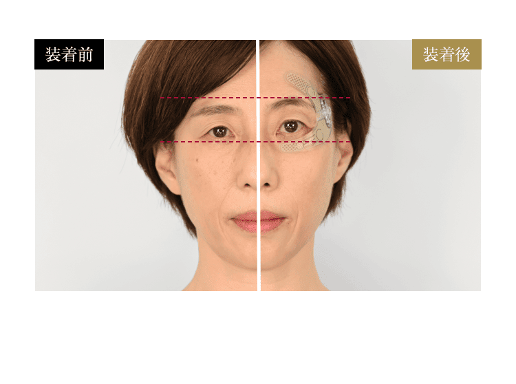 装着時の引き上がり比較／写真：装着前・装着後