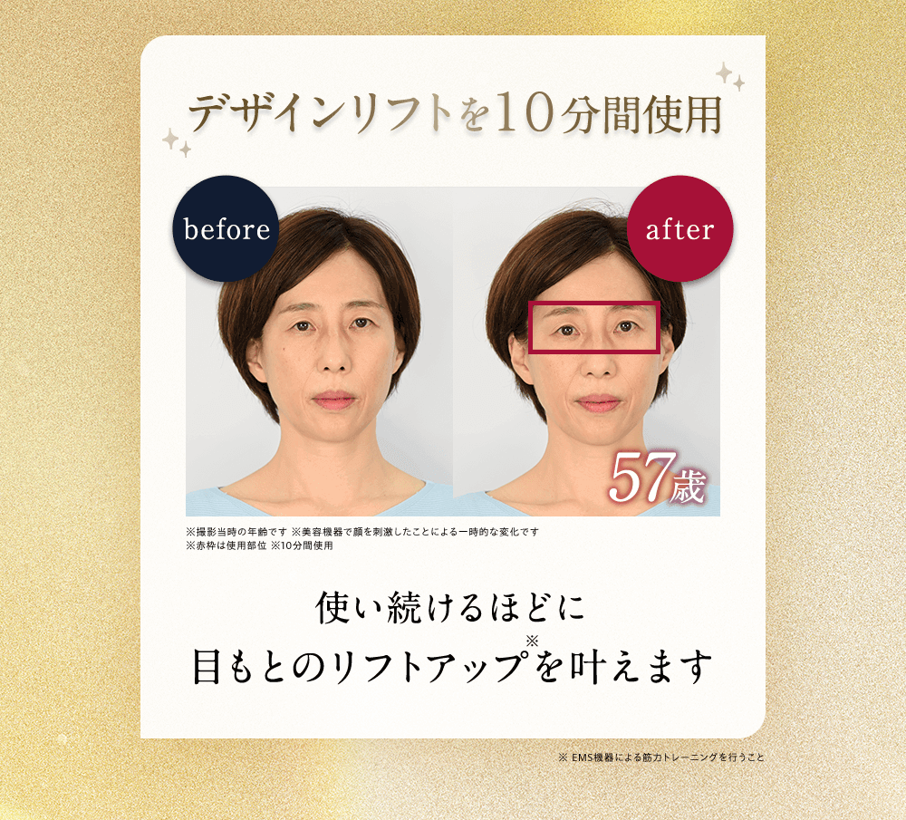 デザインリフトを１０分間使用 使い続けるほどに目もとのリフトアップ※を叶えます ※EMS機器による筋⼒トレーニングを⾏うこと