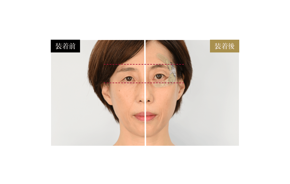 装着前　装着後