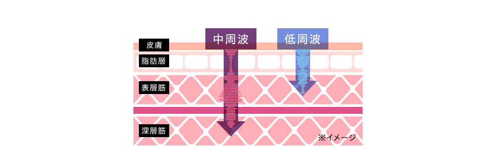 デザインリフトは 低周波と中周波の組み合わせで筋肉の表層と深層両方にアプローチ。