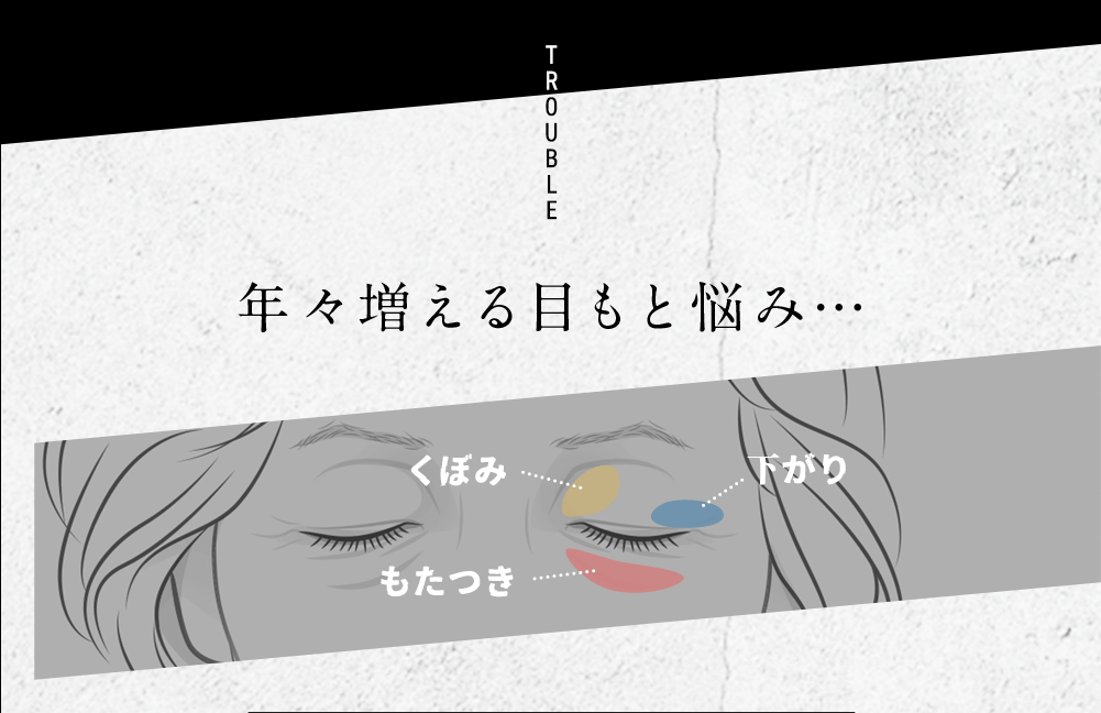 TROUBLE 年々増える目もと悩み… くぼみ もたつき 下がり