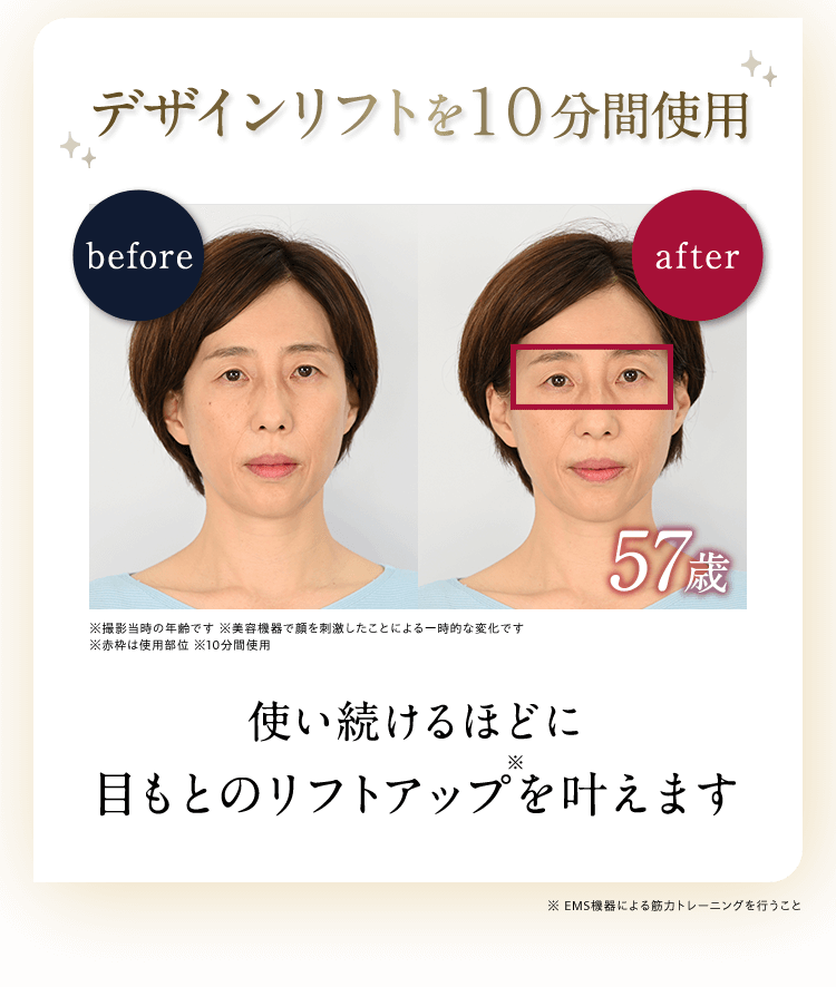 貼るリフトアップ美顔器 『デザインリフト モア』 | YA-MAN TOKYO