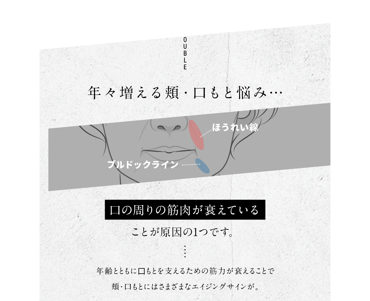 TROUBLE 年々増える頬・口もと悩み… ほうれい線 もたつき ブルドックライン 口の周りの筋肉が衰えていることが原因の1つです。年齢とともに口もとを支えるための筋力が衰えることで目もとにはさまざまなエイジングサインが。