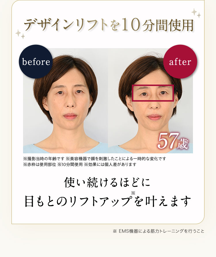 デザインリフトを10分間使用　使い続けるほどに目もとのリフトアップ※を叶えます　※EMS機器による筋力トレーニングを行うこと