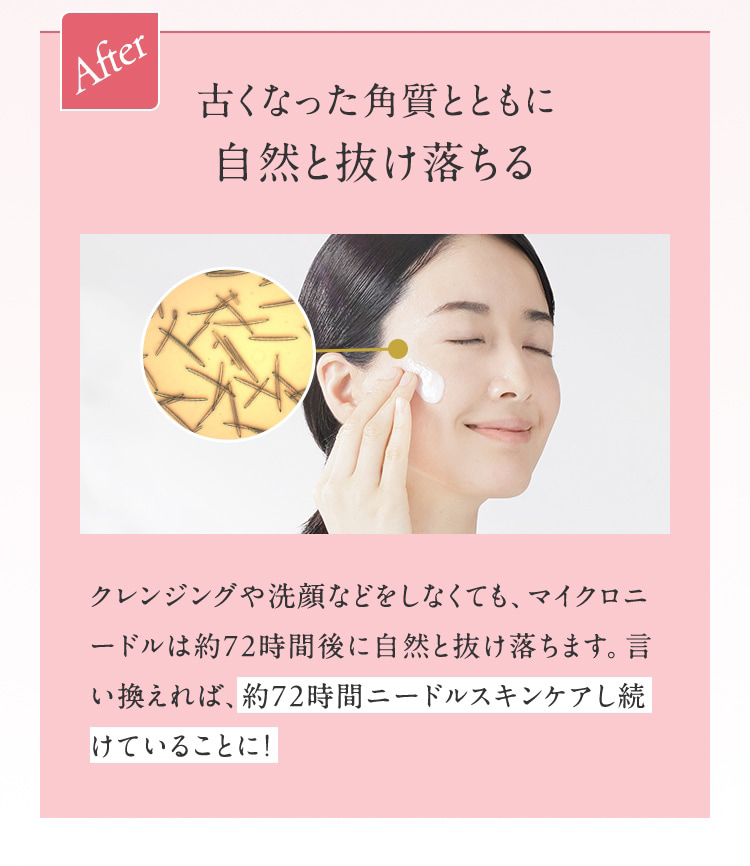 After 古くなった角質とともに自然と抜け落ちる