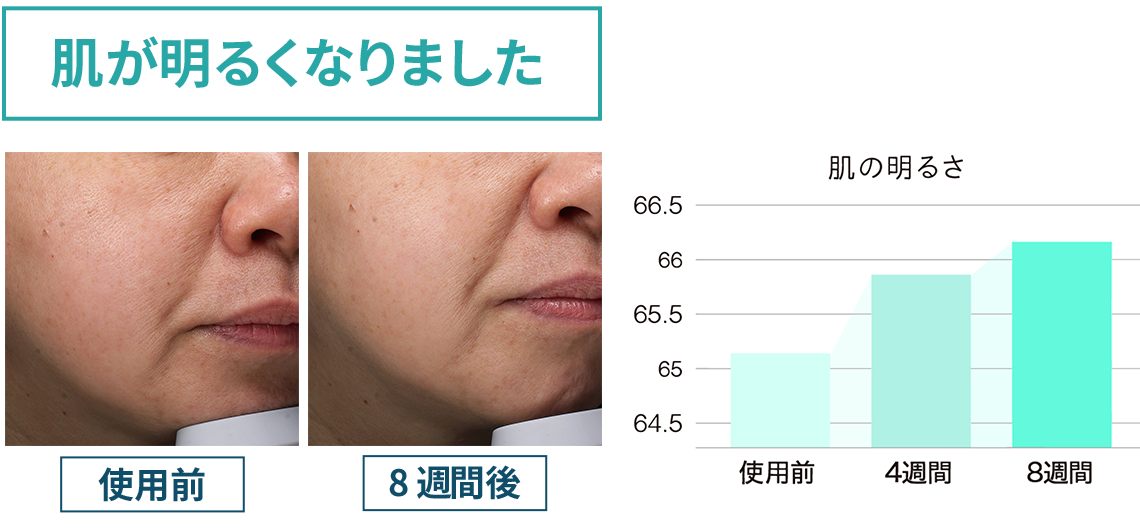 薄い肌色/濃い肌色 自動でハイパワー照射