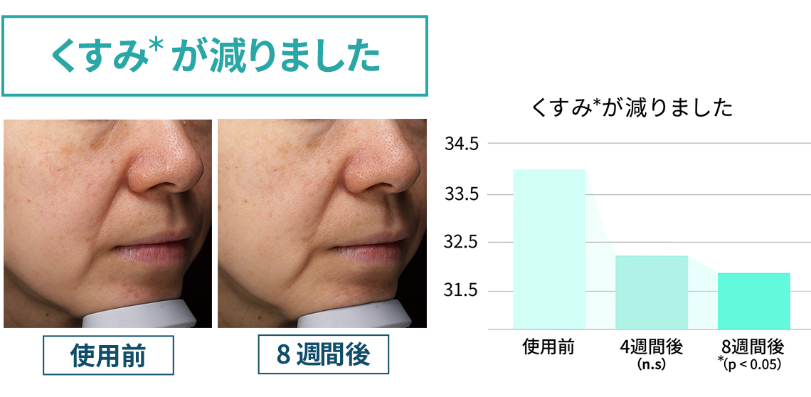 薄い肌色/濃い肌色 自動でハイパワー照射