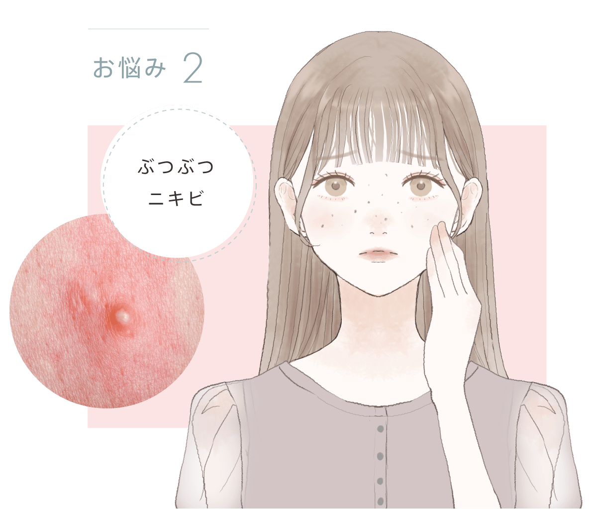 ディープスキンクリア | スプーンヘッドで気になる角栓をディープオフ