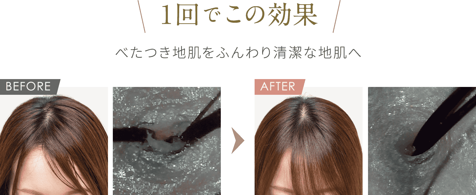 1回でこの効果