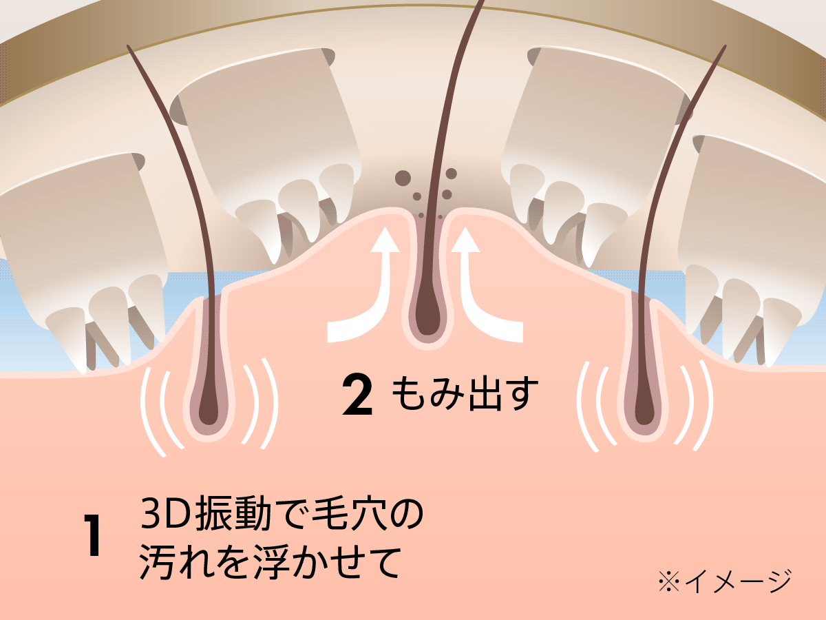 頭皮イラスト