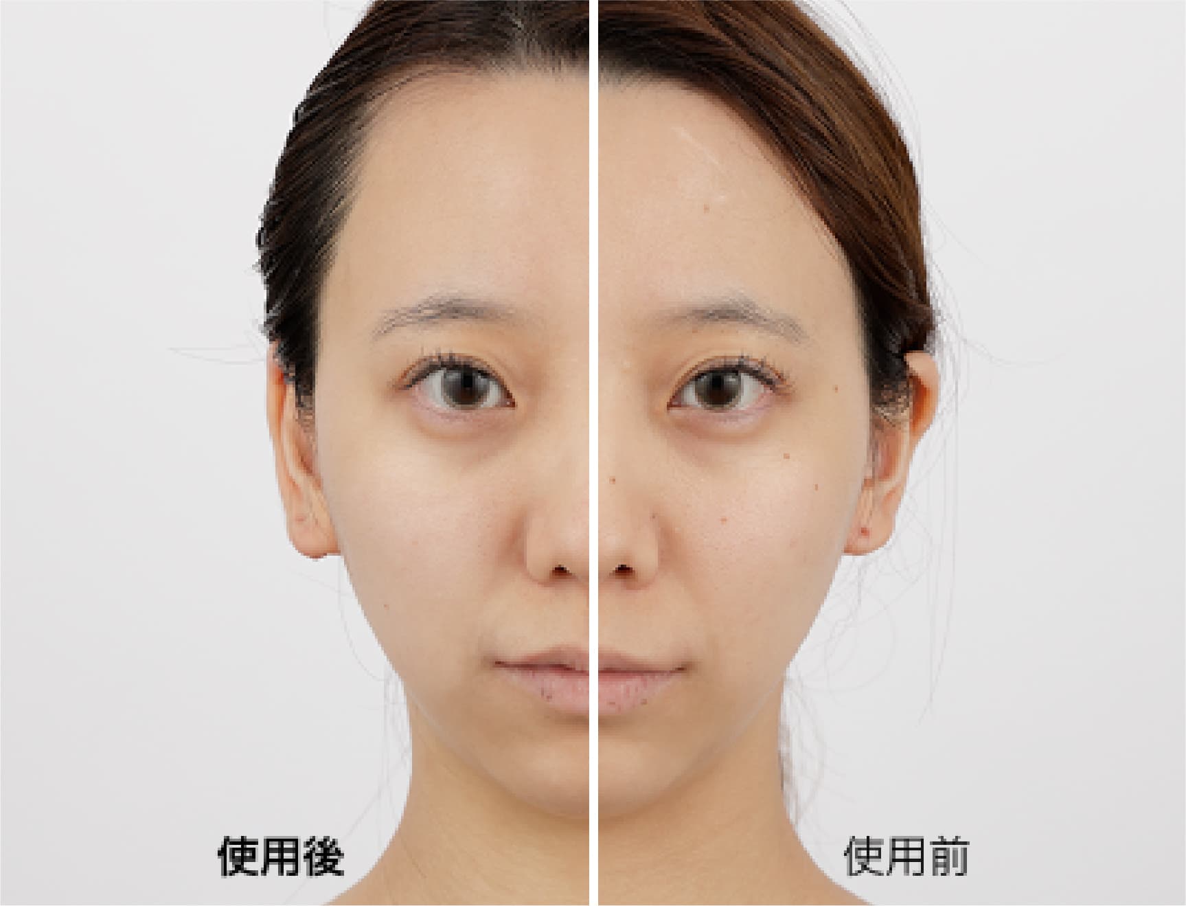 ゼジュラの投与量