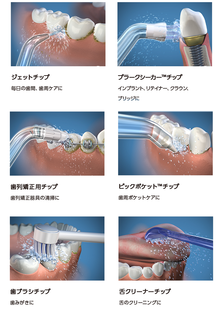 ウォーターピック コードレスセレクト | ヤーマン公式通販サイト